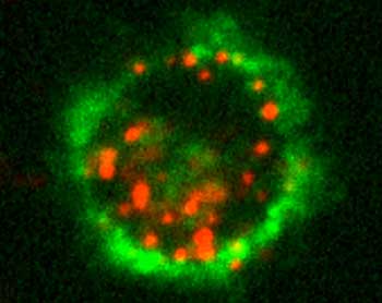 Internalized nanoparticles (red) in a Langerhans cell (green membrane marker)