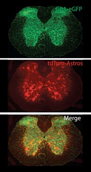 Astrocytes
