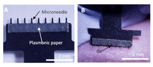 Plasmonic Paper Microneedle Patch