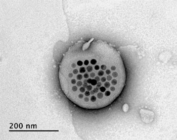 Electron microscope image shows a liposome, the white blob at center, with its magnetic particles showing up in black