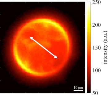 A dye labelled membrane seen under polarized light