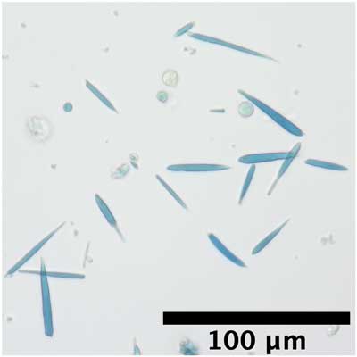 magnetic protein crystals that were stained with a blue dye that binds to iron