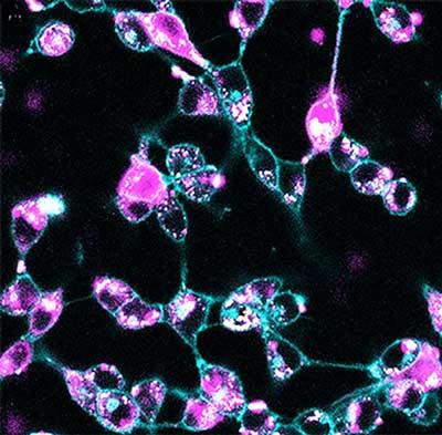 Fluorescent-Tagged Nanoparticles
