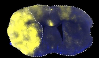 Fluorescently labelled liposomes selectively translocated into the stroke area left side of brain