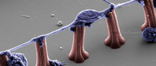 Growth of macroscopic directed networks of human human neural stem cells on CNT micropillar templates
