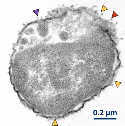 A Klebsiella pneumoniae bacteria exposed to motorized nanomachines