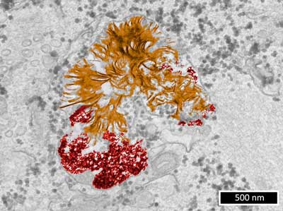 transmission electron microscopy image of a lysosome