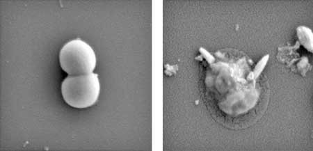 Golden Staph bacteria before (left) and after (right) exposure to the magnetic liquid metal nanoparticles