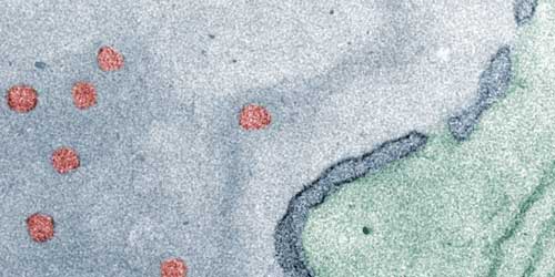To enter into the cell nucleus (grey), the polymersomes (red) must selectively translocate across the nuclear membrane (dark blue) via the nuclear pore complexes (gaps in the membrane)