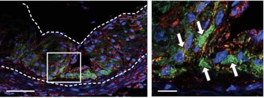 nanoparticles in tissue