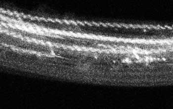 TEM of Atomic Chains
