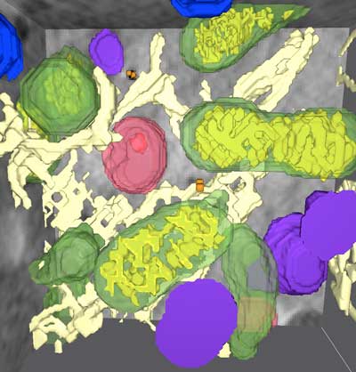 3D architecture of the cell with different organelles:  mitochondria (green), lysosomes (purple), multivesicular bodies (red), endoplasmic reticulum (cream)