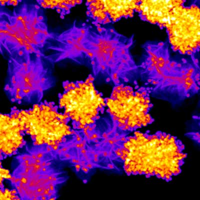 Electron microscope image showing preferential deposition of gold nanoparticles onto transition metal ditellurides relative to the disulfide counterparts