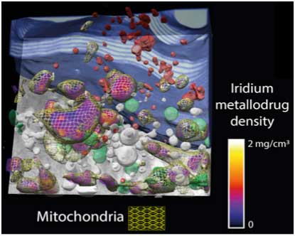 3D section of a cryopreserved breast cancer cell