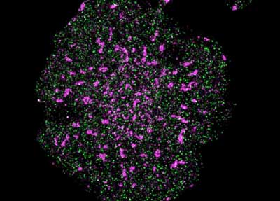 A T cell with precise localisation of T cell receptors (pink) and CD45 phosphatase (green)