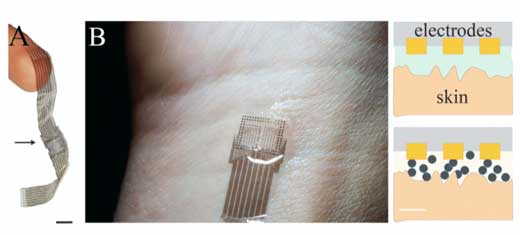Conformable electronics and high-quality noninvasive electrophysiological recording by mixed-conducting particulate composites