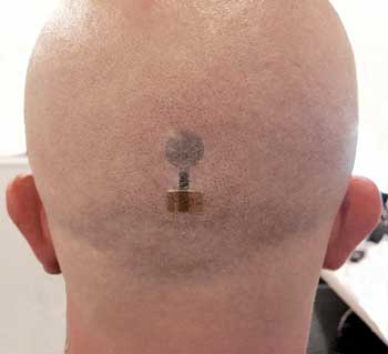 tattoo electrode atatched to shaved head