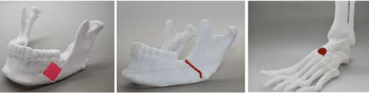 3D printed jaw, foot models