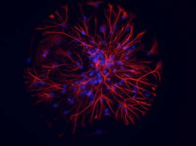 Colored Image of Neurons and Astrocytes