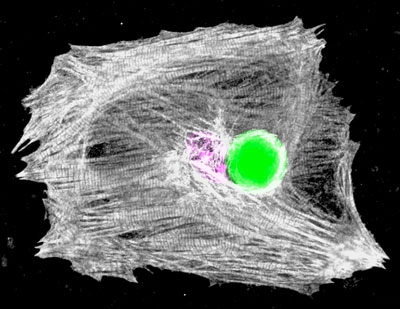 Microscopy image of a heart muscle cell with a tiny embedded laser emitting bright green light