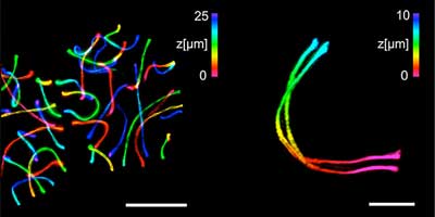 sperm-forming cells expanded with ExM-SIM and imaged with a diffraction limited microscope and a detailed 3D image of a single synaptonemal complex
