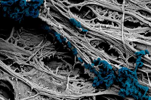  scanning electron microscope image of cultured neural cells