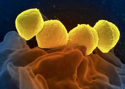 bacteria