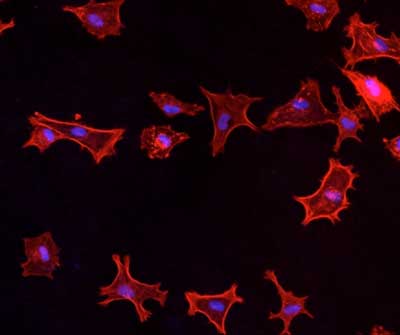 connective tissue cells