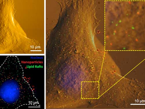 Image of a cell with fluorescent dots to show nanoparticles