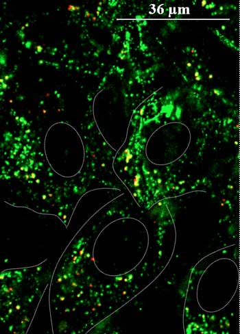 Black background with green dots showing nanoparticles in a cell