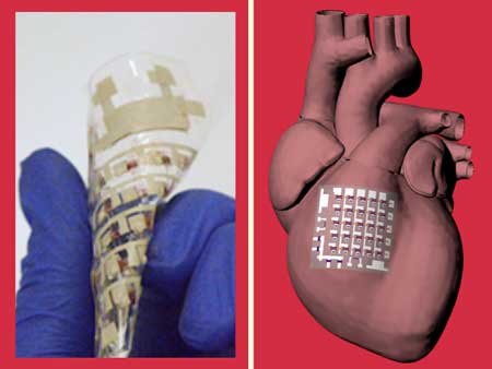 cardiac patch made from fully rubbery electronics