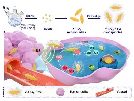 V-TiO2 nanospindles encased in polyethylene glycol (PEG) and used in combination with ultrasound waves can kill cancer cells 
