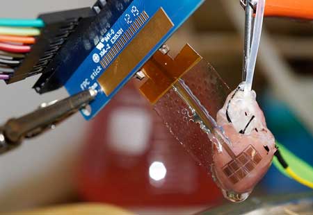 soft electronics attached to tissue