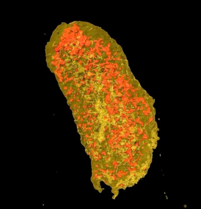 A nanoscale X-ray scan of an E.coli bacteria