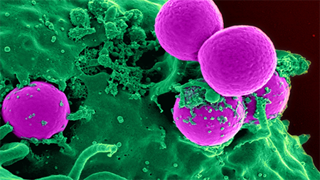 NOVA - Official Website | Arms Race With a Superbug