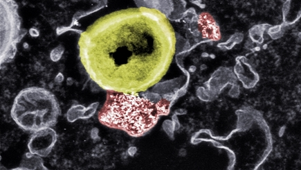 nanoparticles (red) can kill resistant bacteria (yellow)