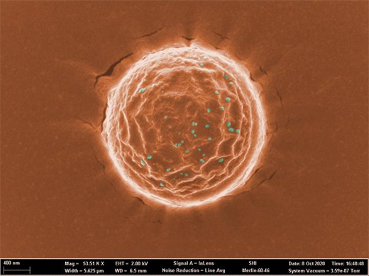 Scanning electron microscope (SEM) image of Nanotrap (orange) binding pseudotyped SARS-CoV-2 virus (cyan)