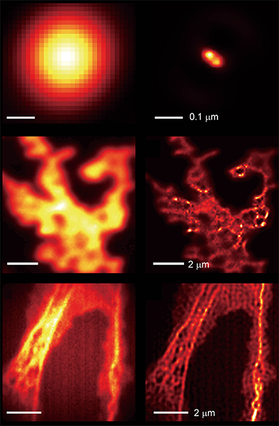 Comparison of images taken by a light microscope with and without hyperbolic metamaterial