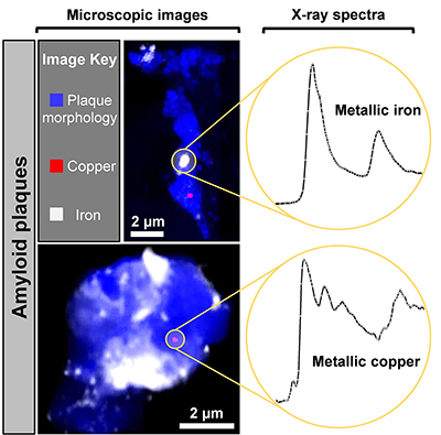 X-ray microscope images and X-ray absorption spectra obtained from two Alzheimer's disease plaque cores
