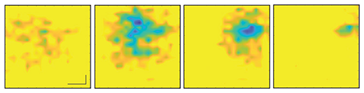 sequence of images of a beating heart
