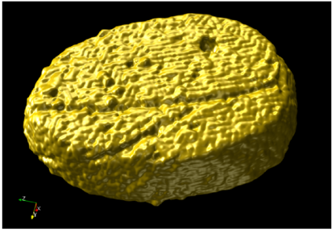 STEM tomography image of a 3D-grown 100-200-nanometer crystalline disc grown from 3D gold-polystyrene polymer-grafted nanoparticles