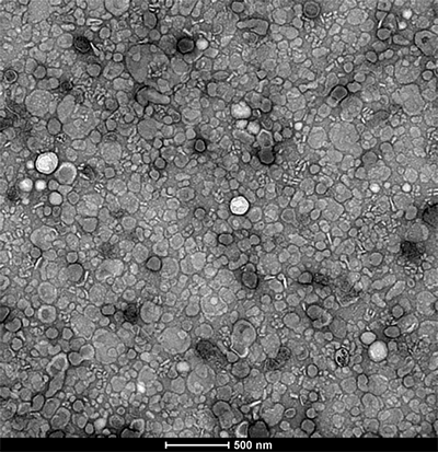 Electron micrograph of exosomes isolated from unpasteurized cow’s milk