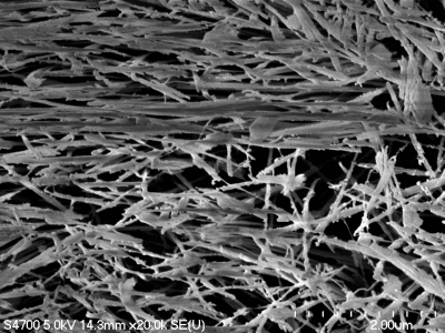 A microscope image of plasma-etched polymer that shows the strands of the polymer