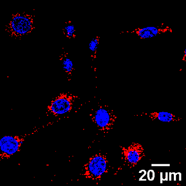 Gold nanoparticles (red) become internalized by cells and accumulate around the nucleus (blue)