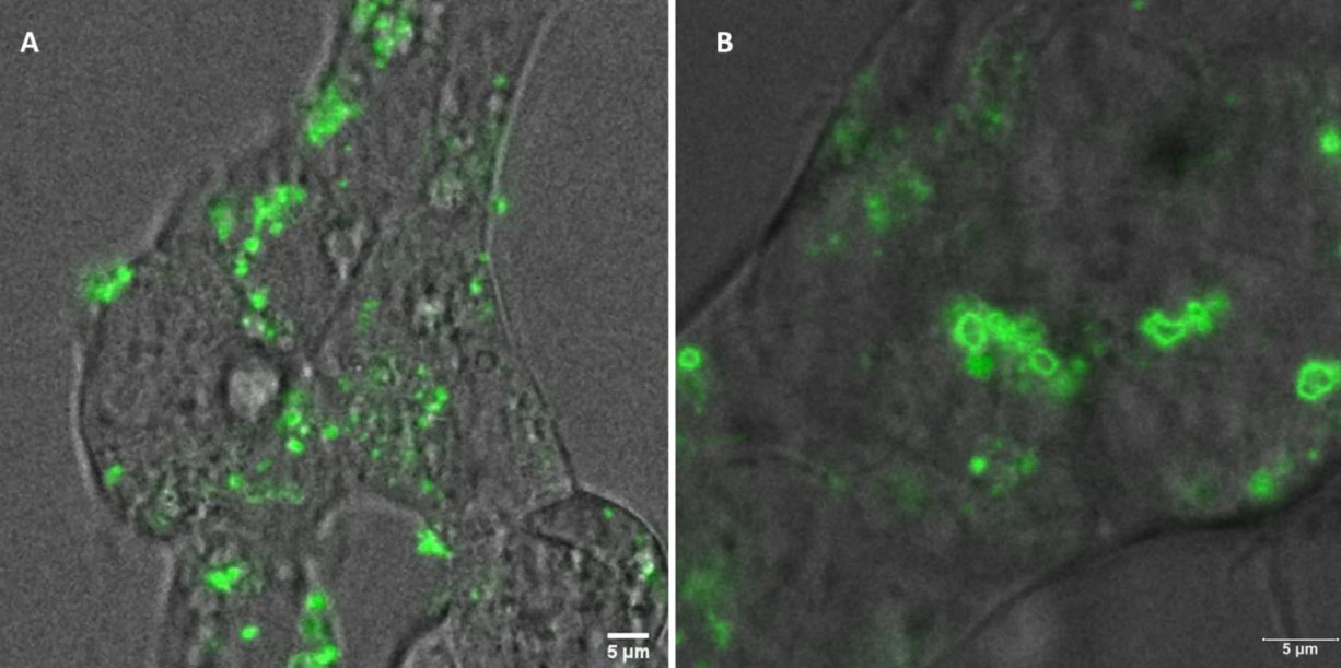New fluorescent nanovesicles for intracellular biomarker detection