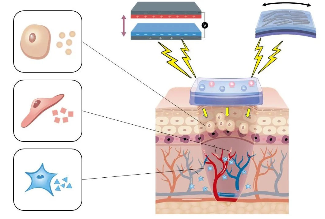 Piezoelectric and triboelectric nanogenerators for self-assisted wound healing