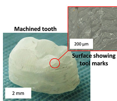 composite material sculptured into the shape of a tooth