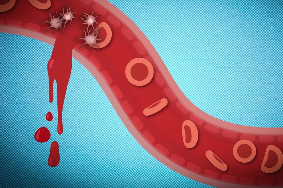 stopping internal bleeding with nanoparticles