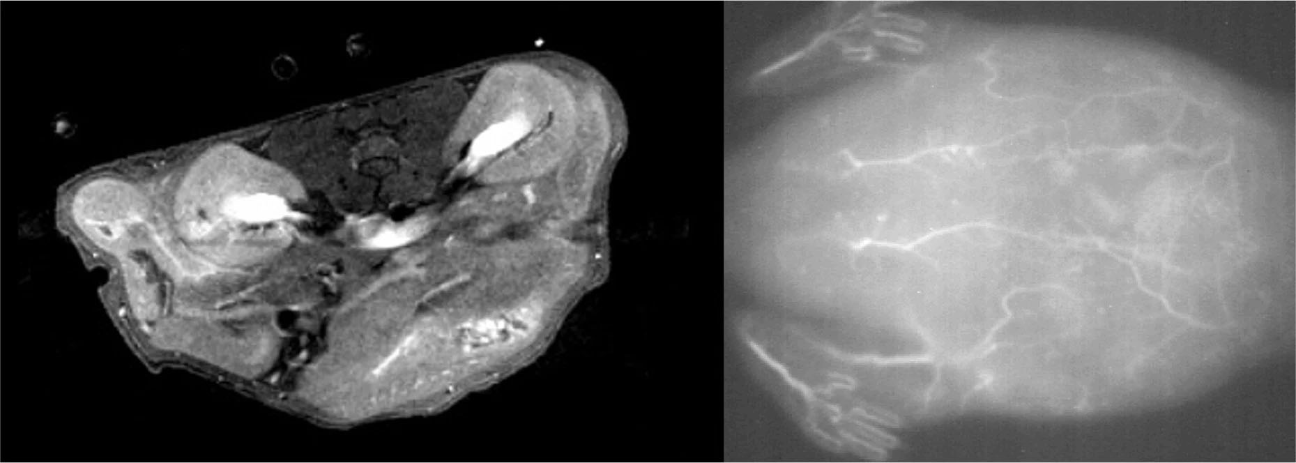 MRI (left) and near-infrared fluorescence (right) scans of tissues and blood vessels