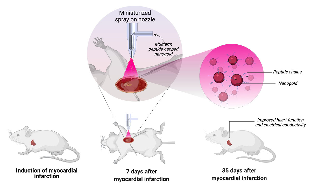 Nanoengineered Sprayable Therapy for Treating Myocardial Infarction